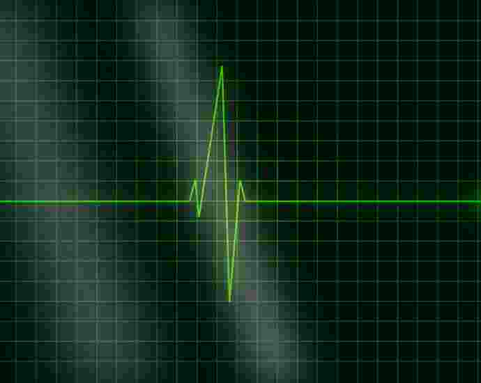 electrocardiogram, ecg, heartbeat