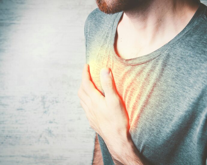 Тахикардија