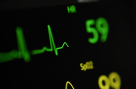 како да се намали пулсот